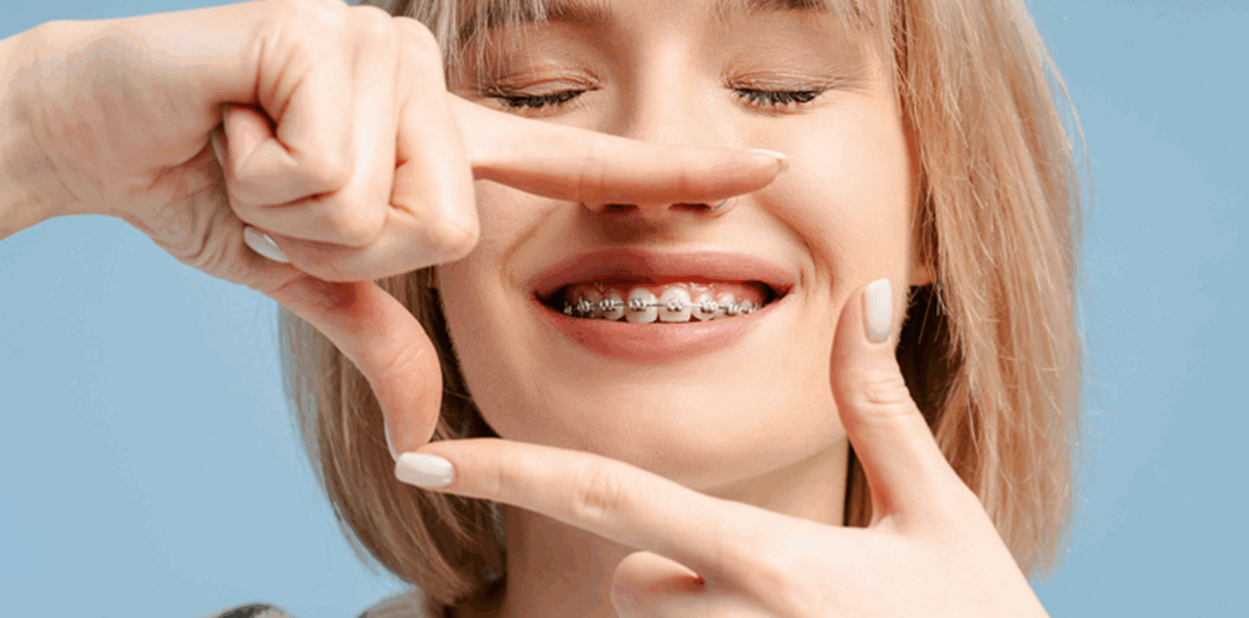 Woman smiling and using her hands to frame her braces